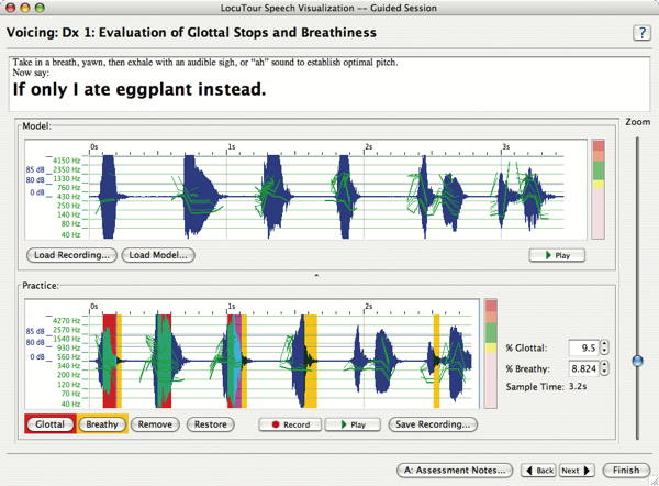 Speech Visualization